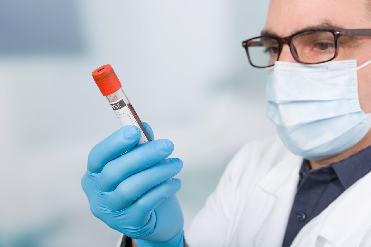 Can You Request an Independent Blood Test After Receiving DUI Charges in Maryland?